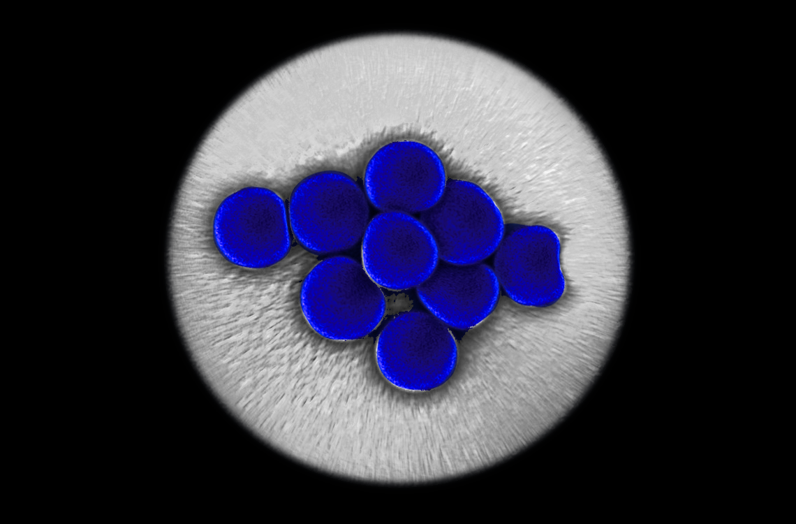 Rare Cell Detection Testing